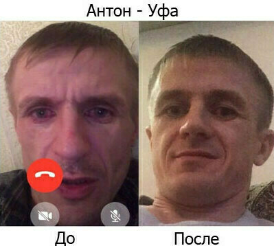 Антон после реабилитации Антон г.Уфа